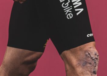 Wout van Aert vertelt openhartig over littekens, worstelingen en de klassiekers waar hij nog steeds van droomt